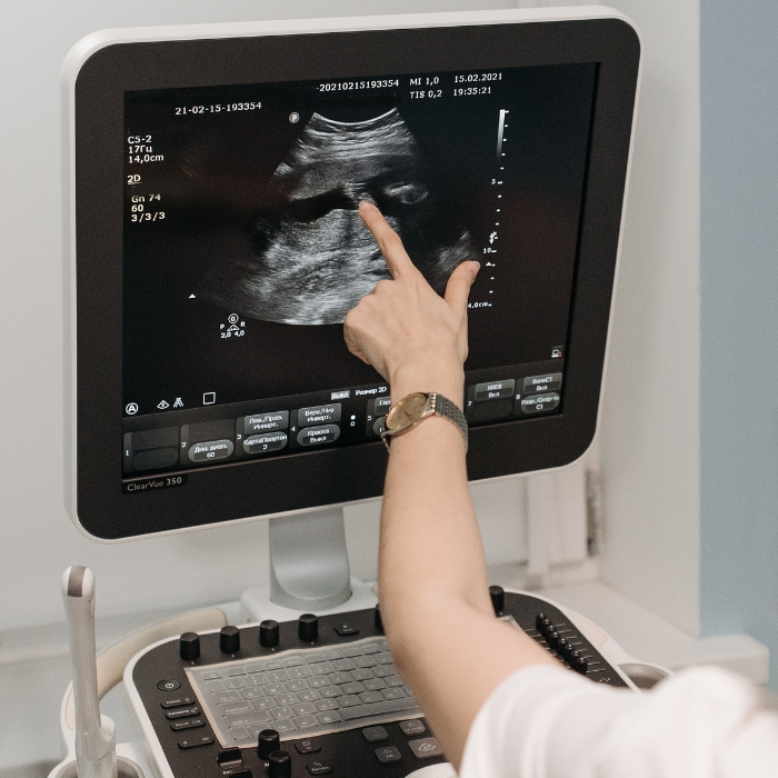 a person pointing at an ultrasound